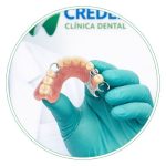 Prótesis dental removible de metal porcelana - Calidad superior