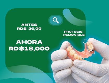 Oferta prótesis dentales 50% descuento en Santiago de los Caballeros - Credent RD
